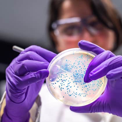 medical device microbiology technician wearing purple gloves and safety glasses does a microbiological evaluation of the organisms in a petri dish